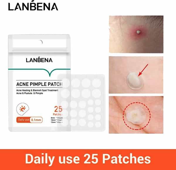 Lanbena Acne Pimple Patch (25 Patches)