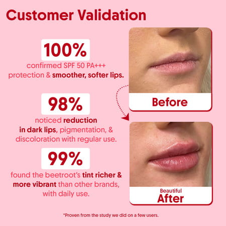 Aravi Organic Beetroot Tinted Lip Balm With Spf 50 Pa+++ | 5 Gm