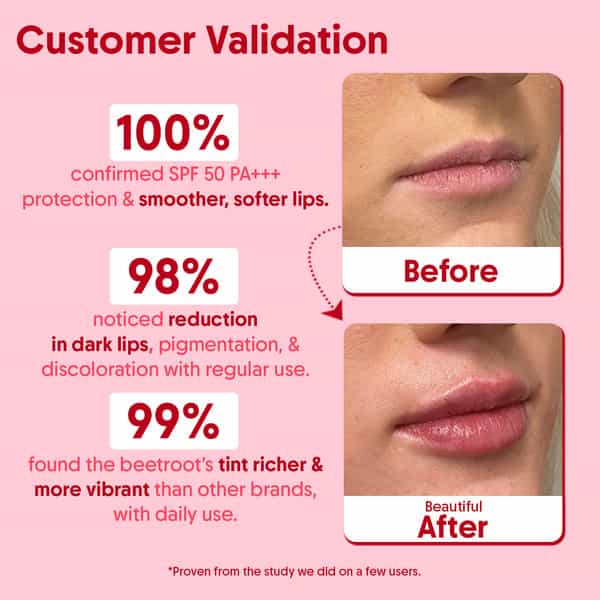 Aravi Organic Beetroot Tinted Lip Balm With Spf 50 Pa+++ | 5 Gm
