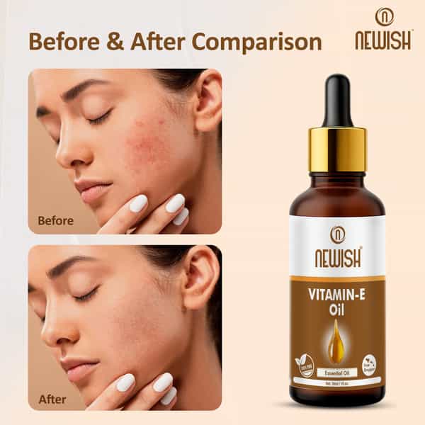 Newish Vitamin E Oil For Hair Growth Face Body Skin (Non Capsule) 30Ml