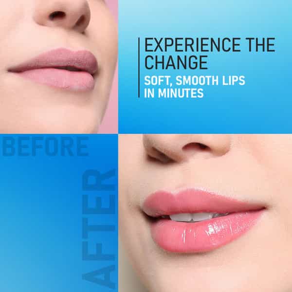 Yuthika Lip Care Balm 5G Pack Of 20 | Intense Moisture | Soft Touch Lip Balm (Jar Pack)