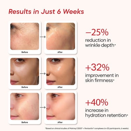 Yourhappyskin Renew Face Serum | Advanced Wrinkle Repair & Firmness | Skin Renewal 30 Ml