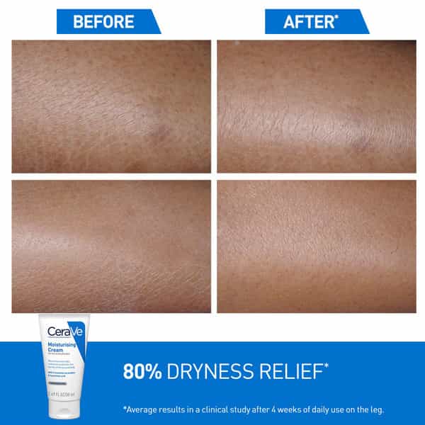 Cerave Moisturizing Cream For Dry To Very Dry Skin - 50Ml