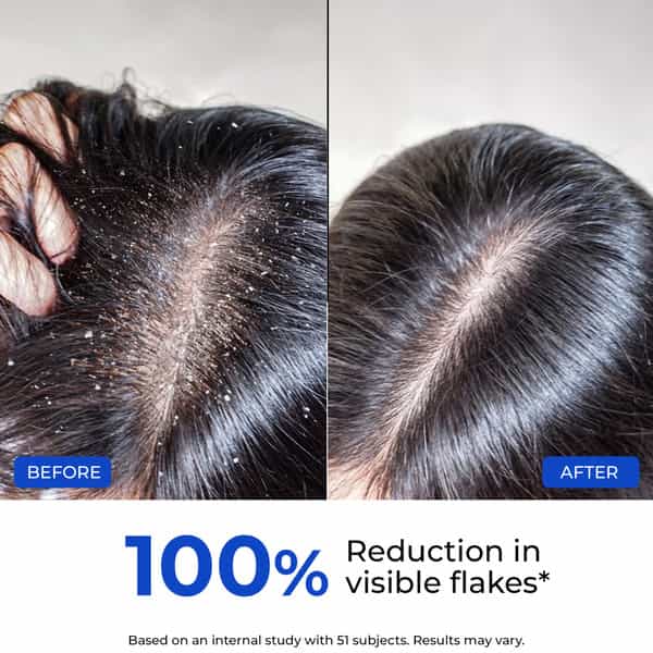Conscious Chemist Anti-Dandruff Ultra Hydrating Conditioner | 100Ml