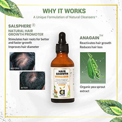 View product image 4
