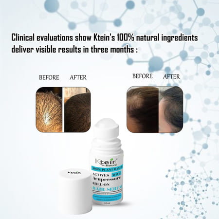 Ktein 100% Plant-Based Active Intensive Hair Treatment Serum With Acupressure Roll-On 30ml