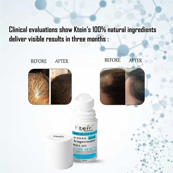 Ktein 100% Plant-Based Active Intensive Hair Treatment Serum With Acupressure Roll-On 30Ml