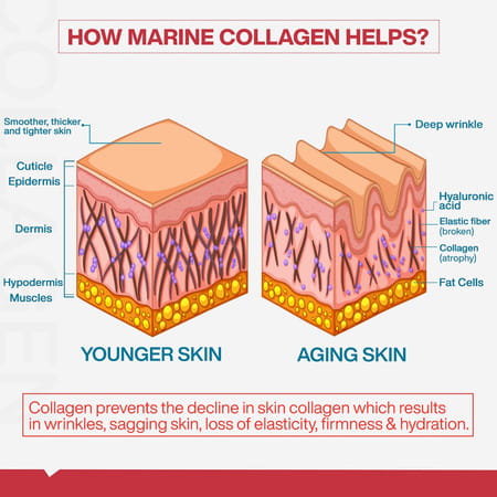Myfitfuel Hydrolyzed Bovine Collagen + Glucosamine, Hyaluronic, Biotin, Zinc Vitaminc (250g, Orange)