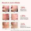 Yourhappyskin Revive Face Serum | Pore Refinement & Skin Clarity | Barrier Repair 30 Ml