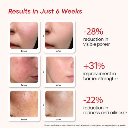 Yourhappyskin Revive Face Serum | Pore Refinement & Skin Clarity | Barrier Repair 30 Ml