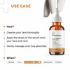 Dermatouch Kojic Acid 2% Serum | Best For Hyperpigmentation & Uneven Skin Tone | 30Ml