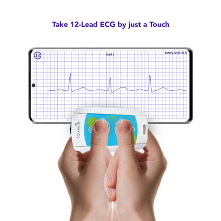 Sanketlife 2.0 Pocket Ecg Device | Unlimited 12 Lead Ecg | Hrv By Touch | Keychain Size Ecg Machine