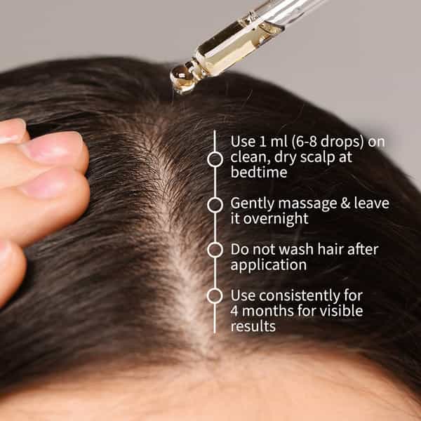 Oziva+ Advanced Hair Growth Serum | Balances Scalp Microbiome & Activates Hair Growth | 30Ml