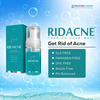 Ridacne Foaming Face Wash | 100 Ml