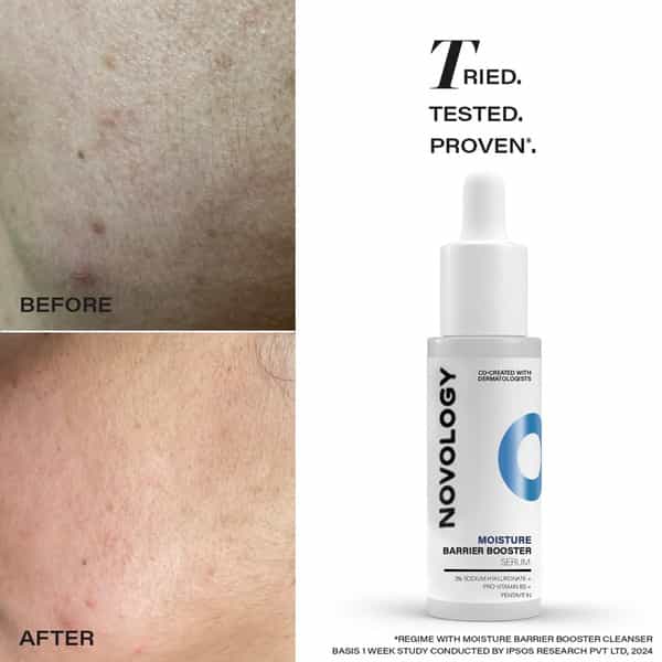 Novology Moisture Barrier Booster Serum (28 Ml)