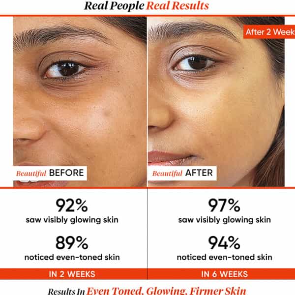 Dot & Key 20% Vitamin C Face Serum (Freshly Made) With Pure L-Ascorbic Acid 25Ml