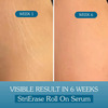 Bake Strierase Stretch Marks Removal Roll-On Serum For Fades Stretch Marks & Scars (50Ml)