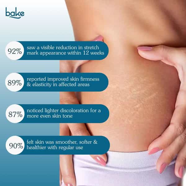 Bake Strierase Stretch Marks Removal Roll-On Serum For Fades Stretch Marks & Scars (50Ml)
