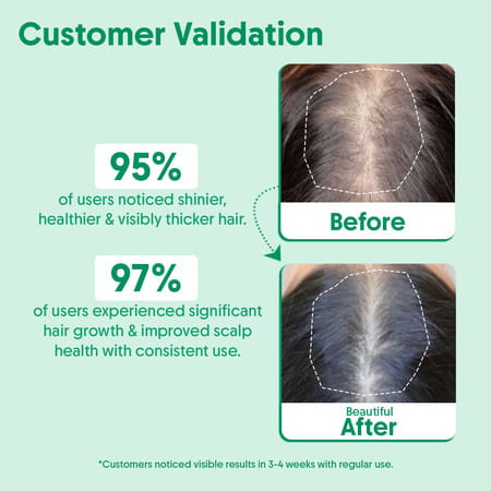 Aravi Organic Rosemary Essential Oil - Promotes Hair Growth | Healthy Scalp & Strengthens Hair 15ml