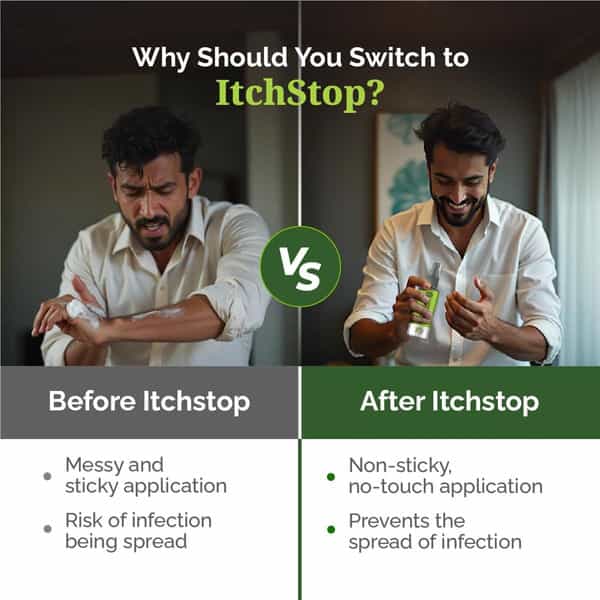 Itchstop Ayurvedic Antifungal Spray For Men & Women 35Ml Pack Of 4