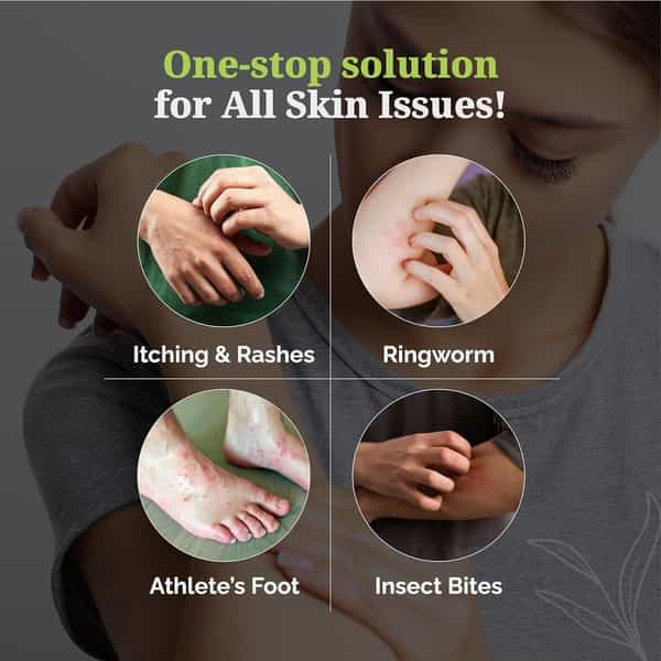 Itchstop Ayurvedic Antifungal Spray For Men & Women 35Ml Pack Of 4