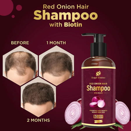 Regal Essence Red Onion Hair Shampoo With Biotin For Healthy Hair-300ml