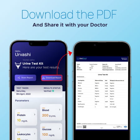 Neodocs Instant Urine Test| Track 10+ Parameters | Sugar | Protein | Liver | Kidney | + More