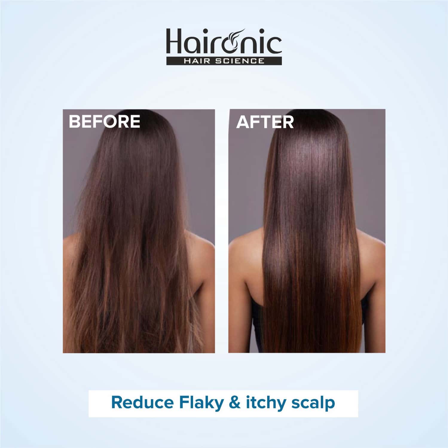 Buy HAIRONIC SALICYLIC ACID EXFOLIATING SCALP OIL & FLAKE CONTROL HAIR
