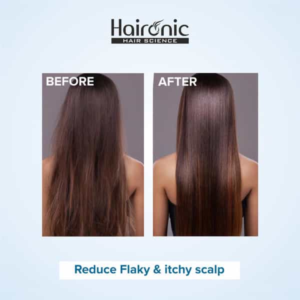 Haironic Salicylic Acid Exfoliating Scalp Oil & Flake Control Hair Serum - 100Ml