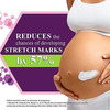 Luciara Anti-Stretch Marks Cream 50G X Pack Of 2