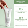 Cos-Iq Aha Glycolic Acid 10% Face Cleanser | Face Wash For Acne & Pimple| Men & Women 100 Ml