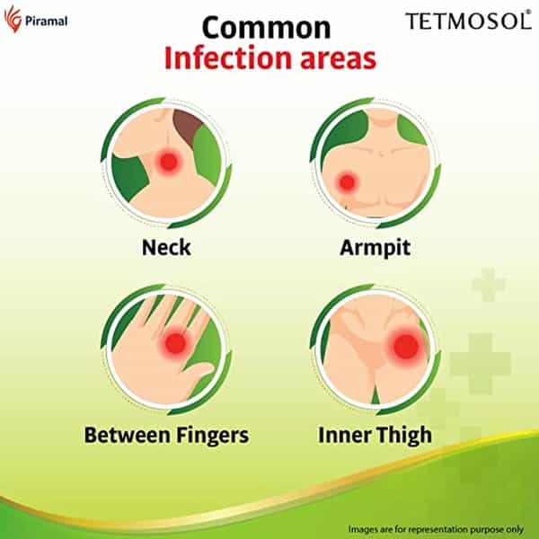 Tetmosol Plus Cream - Topical Antifungal Cream - Pack Of 4 (4 X 10G)