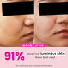 Dot & Key Watermelon 10% Glycolic Serum For Face Glowing | With Kojic | For Oily & Normal Skin 30ml