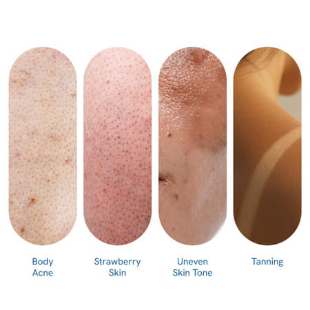 Be Bodywise 5% Aha Bha Exfoliating Body Wash | For Body Acne Strawberry Skin De-Tan | 250ml