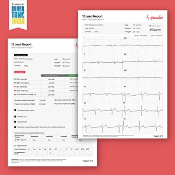 Spandan Portable 12- Lead Ecg Device | Ecg In 10 Seconds | Pocket Size | For Clinical & Personal Use