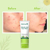 Wishcare 2% Salicylic Acid Face Wash With Aha | Greentea Chamomile - For Oil Acne Control (100Ml)