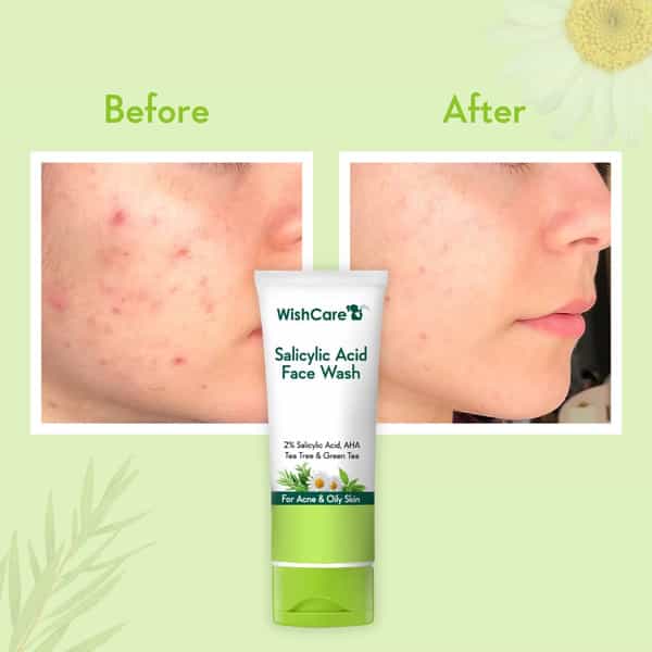 Wishcare 2% Salicylic Acid Face Wash With Aha | Greentea Chamomile - For Oil Acne Control (100Ml)