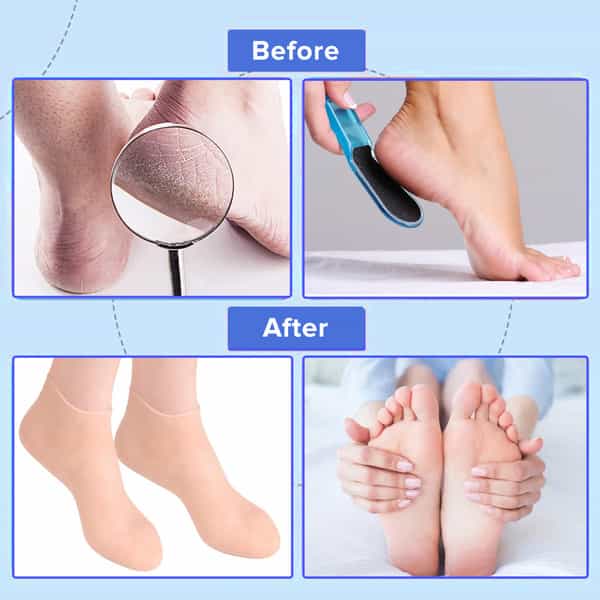 Dr Foot Silicone Socks | Anti Slip Silicone Moisturizing Socks | Dry Cracking Skin | Size M - 1 Pair