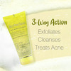 Acnedew Anti Acne Face Wash 3-Way Action Cleanser With Glycolic Acid | Normal To Oily Skin 100 Ml