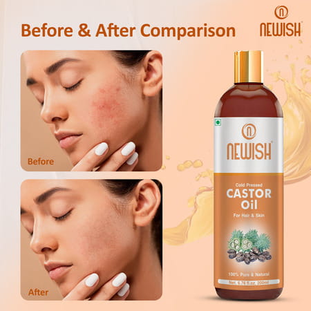 Newishcastor Oil For Hair Growth|100% Pure&Organic|For Dryskin Nailcare Eyelashes-200ml (Pack Of 2)