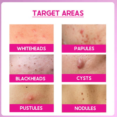 View product image 5