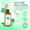 Spantra Anti Acne Facial Serum 50Ml