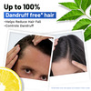 Sesa Ayurvedic Anti Dandruff Shampoo With Neem Lemon Helps Reduce Hairfall Controls Dandruff 500 Ml
