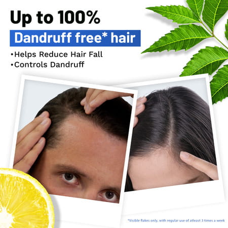 Sesa Ayurvedic Anti Dandruff Shampoo With Neem Lemon Helps Reduce Hairfall Controls Dandruff 500 Ml