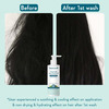 Wishcare Ceramide Anti Dandruff Conditioner For Dry & Frizzy Hair - 200Ml