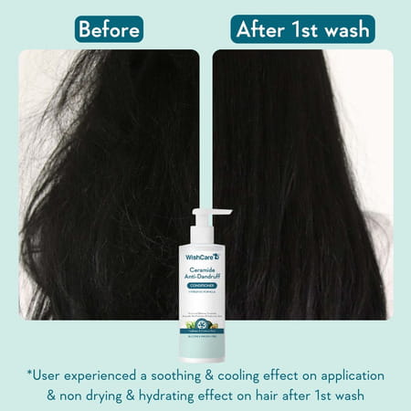 Wishcare Ceramide Anti Dandruff Conditioner For Dry & Frizzy Hair - 200Ml