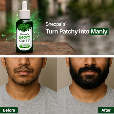 Sheopal'S| Beard Growth Serum|Beard Oil For Men |Beard Oil For Patchy Beard |Mustache Beard Oil 35ml