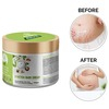 Healofy Naturals Stretch Marks Cream -100G