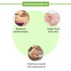 Healofy Naturals Stretch Marks Cream -100G