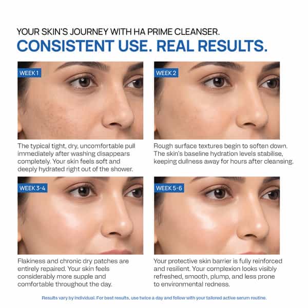 Yuderma Ha Prime Hydro-Infusion Cleanser | With 2X Hydro Boost | Moisturiser Foaming Cleanser |100Ml